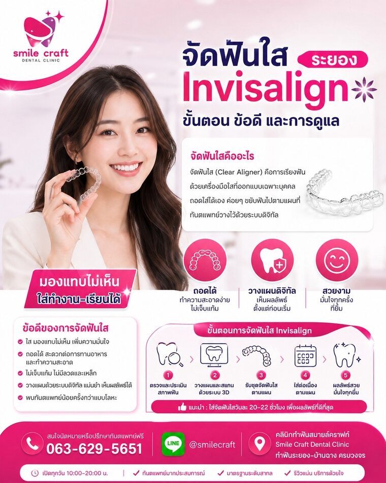 จัดฟันใส Invisalign ระยอง ขั้นตอน ข้อดี และการดูแล