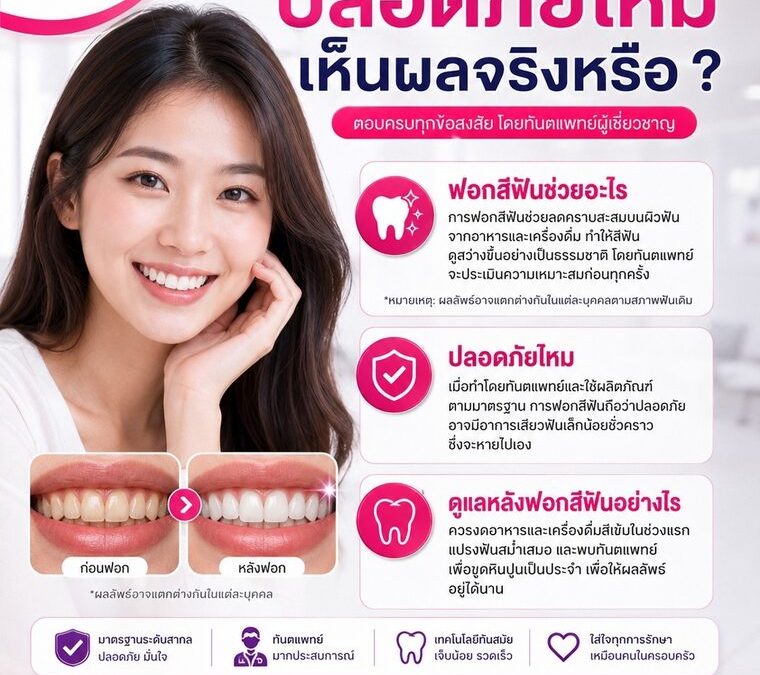 ฟอกสีฟันระยอง ปลอดภัยไหม เห็นผลจริงหรือ | Smile Craft