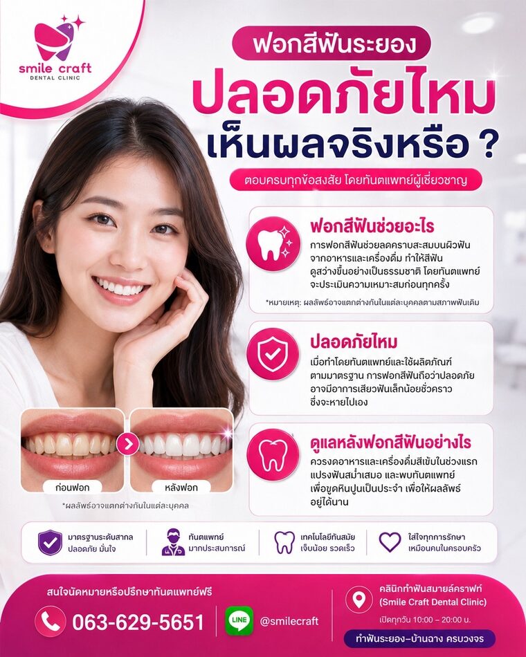 ฟอกสีฟันระยอง ปลอดภัยไหม เห็นผลจริงหรือ