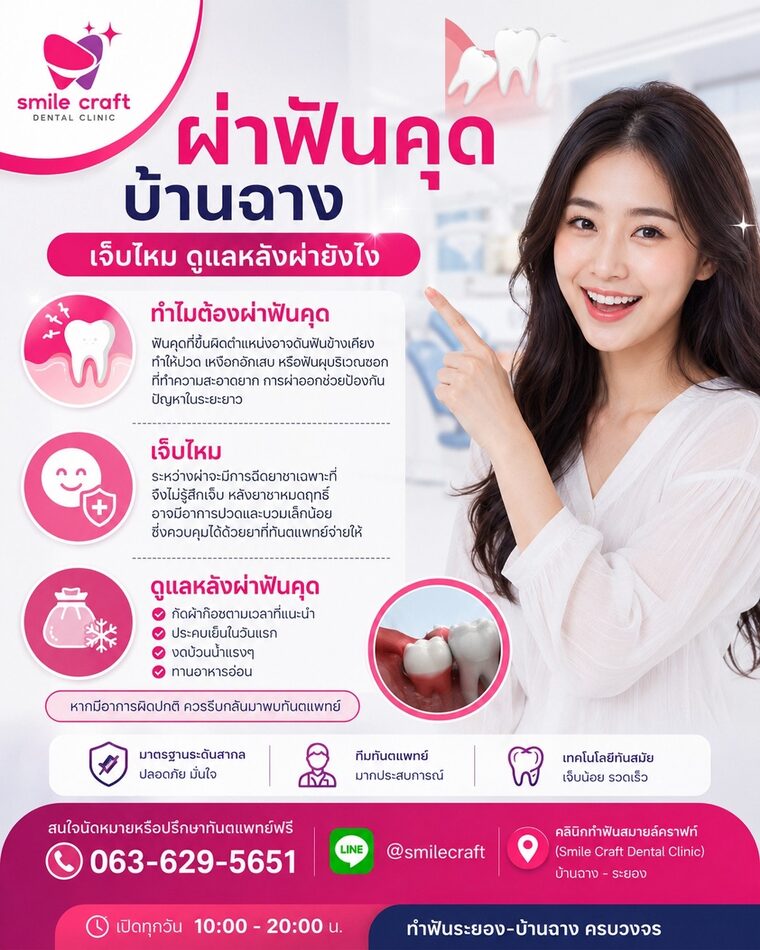 ผ่าฟันคุด บ้านฉาง เจ็บไหม ดูแลหลังผ่ายังไง