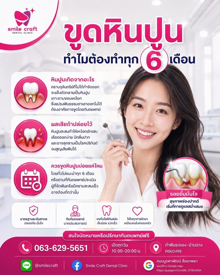 ขูดหินปูน ทำไมต้องทำทุก 6 เดือน