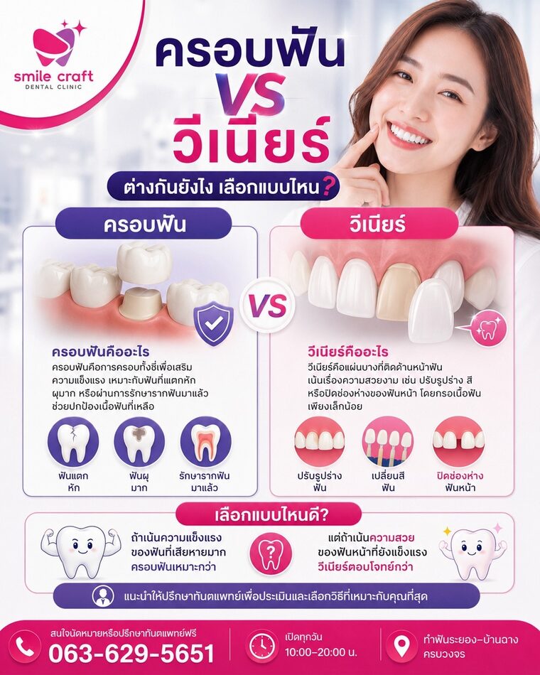ครอบฟัน vs วีเนียร์ ต่างกันยังไง เลือกแบบไหน