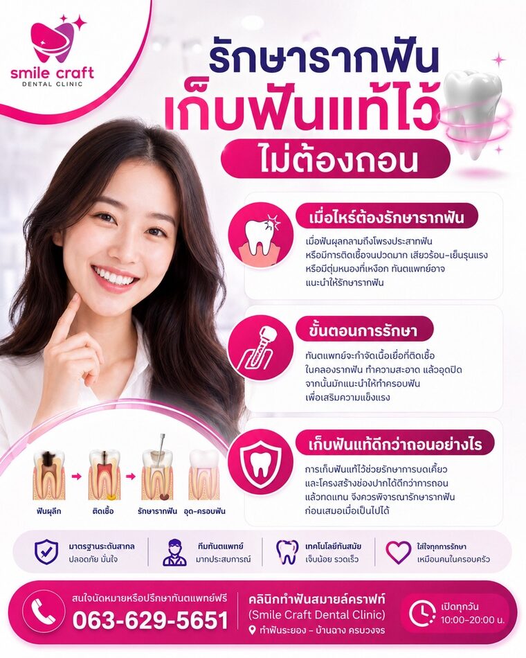 รักษารากฟัน เก็บฟันแท้ไว้ ไม่ต้องถอน