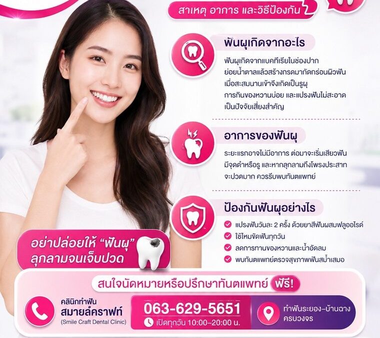 ฟันผุ สาเหตุ อาการ และวิธีป้องกัน | ทำฟันระยอง Smile Craft