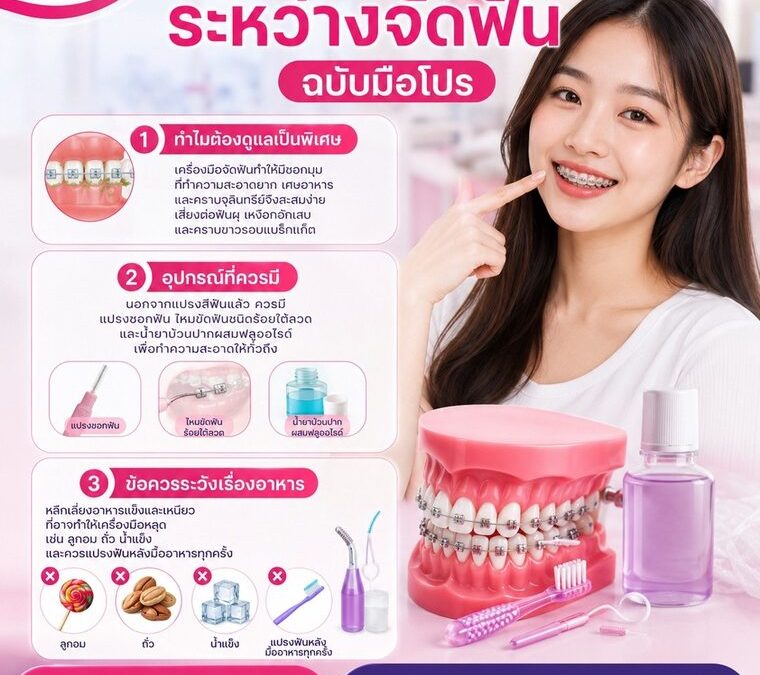 ดูแลช่องปากระหว่างจัดฟัน ฉบับมือโปร | ทำฟันระยอง Smile Craft