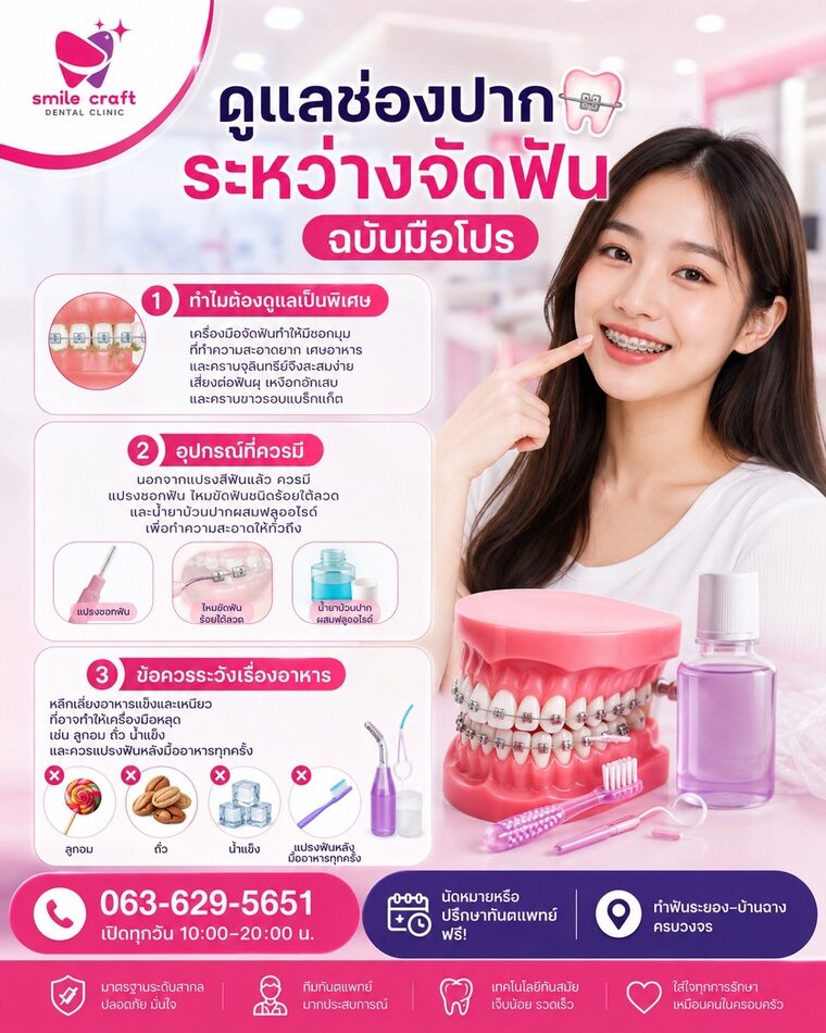 ดูแลช่องปากระหว่างจัดฟัน ฉบับมือโปร